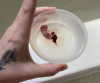 Image from  @LiveAction X post in March 2026: This 9-week-old baby was killed by the abortion pill. A Reddit user shared the photo & called the experience of seeing her baby "traumatizing."