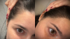 Hair Growth Before and After