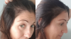 Hair Growth Before and After