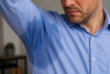 Sofdra® treats the medical condition of primary axillary hyperhidrosis, which causes excessive underarm sweating that is not triggered by heat or exercise.