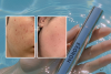 Skin Flooding Cover