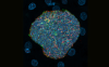 A late liver-stage malaria parasite growing inside an infected liver cell, expressing different antigens for immune education (red and green). DNA from the parasite (center) and neighboring uninfected liver cells (smaller circles) are shown in blue.
