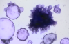 Researchers from Monash University and Hudson Institute of Medical Research have developed an organoid model that incorporates both the intestinal lining and its bacteria. Image credit: Monash University.