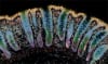 Image taken through spatial transcriptomics showing patterns of cell death-related genes in gut tissue from people with inflammatory bowel disease. Credit: WEHI