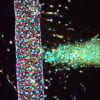 A lab-grown blood vessel (left) interacting with brain cancer cells (right). By recreating these interactions, researchers hope to better understand how tumours grow and identify new ways to deliver life-saving drugs to the brain. 
Credit: UQ