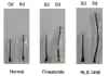 Figure Legend:
Representative images of intact ex vivo human hair follicles challenged with DHT 100 nM and stimulated with finasteride 600 nM (positive control) or RLS-1496 2000 nM at Days 0 and 6.