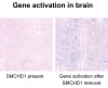 Blue staining shows gene activity in mouse brain tissue after SMCHD1 was removed (right). The finding demonstrates a new way to reactivate healthy genes that are normally silenced in Prader-Willi syndrome. 
Credit: WEHI
