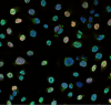 Under a microscope, DNA repair is visible as bright green spots ("foci") in the blue-stained cell DNA. Orange highlights actively growing cancer cells.
Credit: WEHI 
