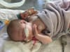 Baby Marlie was hospitalised with RSV at just two weeks old