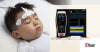 Masimo SedLine® Brain Function Monitoring