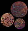 One of the images on display as part of the Art of Discovery exhibition - this is 'Faces of Pancreatic Cancer', a microscopy series by Henry Barraclough-Franks