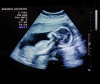 No doctor, nurse or midwife should be forced to kill a baby.
